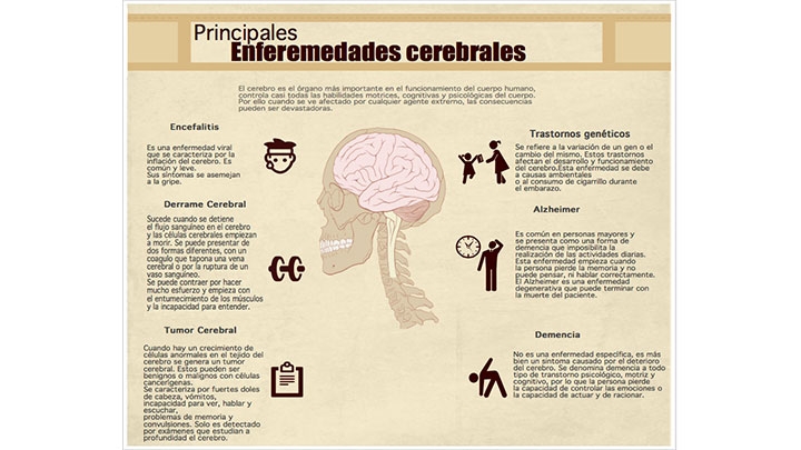 Infografía cerebro