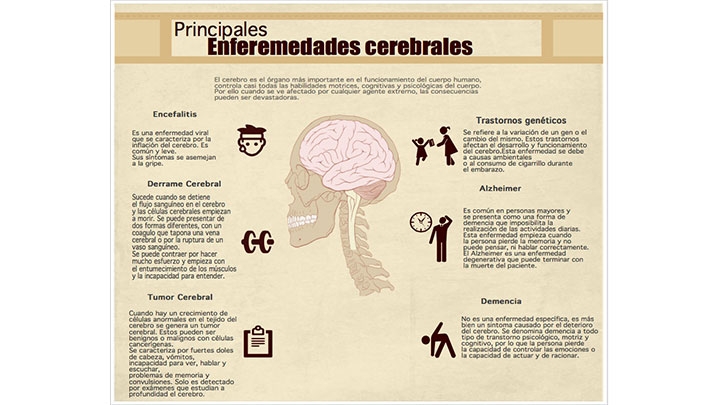 Infograf&iacute;a cerebro