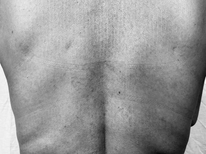Mi cuerpo me&hellip; &iquest;repugna?
