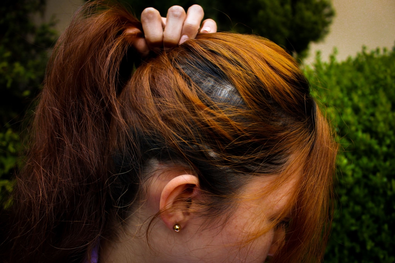 Silenciosa, dolorosa y costosa: así es la vida de una persona con alopecia